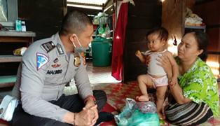 Berkat Bantuan Semua Pihak, Bayi Tanpa Anus Akhirnya Berhasil Dioperasi