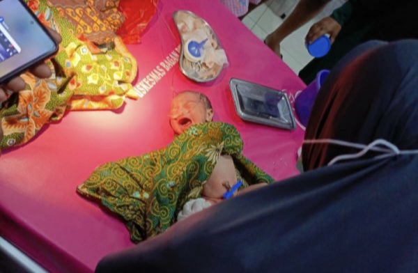 Bermula dari Suara Tangisan, Warga Temukan Bayi Malang Perempuan Dibungkus Daster