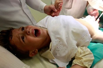 'Terpedo' Bocil Warga Kuansing Riau Ini Terpotong Saat Sunat Massal