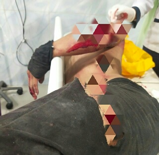 Ditegur Karena Meludah, Penjual Buah Dikeroyok Hingga Tubuh Tersayat Pisau Pengupas Nenas 