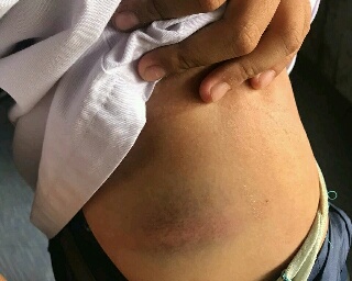 Polisi Tetapkan Santri Senior Pompes Khairul Ummah Tersangka, Korban Pindah Sekolah