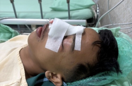 Siswa SMAN 9 Pekanbaru Jadi Korban Perundungan, Keluarga Lapor Polisi