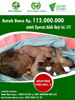 Bayi Lahir dengan Usus Terburai di Inhu Butuh Uluran Tangan untuk Operasi