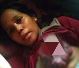 Sempat Viral di Medsos, BJC Inhu Bantu Penderita Kanker Payudara